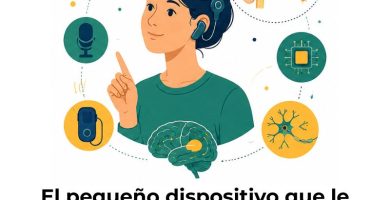 implantes cocleares