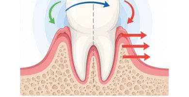 biomecánica dental