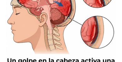 mecanismos biomecánicos del traumatismo craneoencefálico