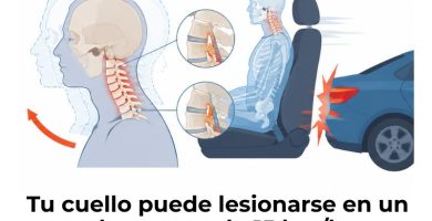 biomecánica del latigazo cervical en accidentes