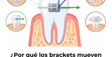fuerzas biomecánicas en ortodoncia