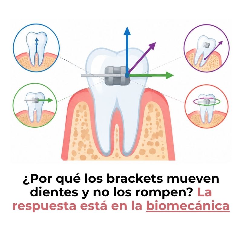 fuerzas biomecánicas en ortodoncia